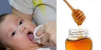 Trẻ co giật vì được đánh tưa lưỡi bằng mật ong