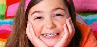 Niềng răng cho trẻ em – Thời điểm nào phù hợp nhất?