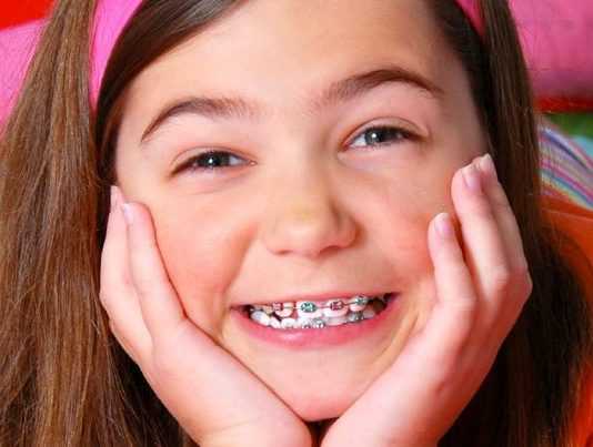 Niềng răng cho trẻ em – Thời điểm nào phù hợp nhất?
