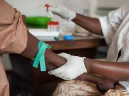 Vòng âm đạo giúp phụ nữ châu Phi ngăn ngừa virus HIV
