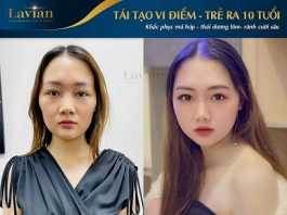 Chuyên gia và khách hàng nói gì về Tái tạo vi điểm?