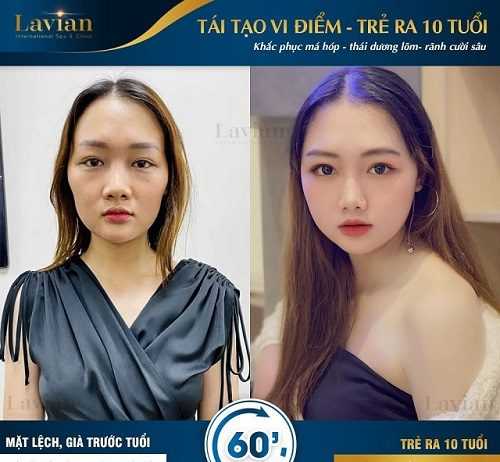 Chuyên gia và khách hàng nói gì về Tái tạo vi điểm?