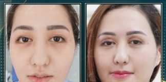 Tin chiêu trò quảng cáo, nhiều khách hàng không khóc