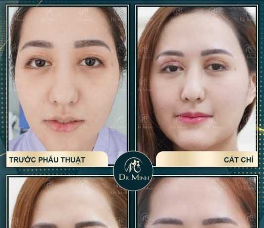 Tin chiêu trò quảng cáo, nhiều khách hàng không khóc