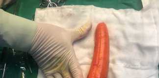 Bác sĩ cảnh báo các thanh thiếu niên bắt chước hành vi không đúng trên mạng gây ảnh hưởng sức khỏe