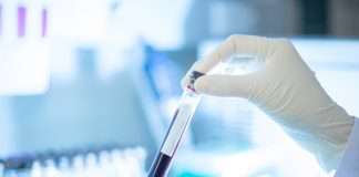 Xét nghiệm máu phát hiện sớm đa ung thư của công ty Grail trên lộ trình xin được FDA cấp phép