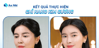 Tại sao công nghệ xóa nhăn bằng chỉ Nano Kim Cương được nhiều người nổi tiếng lựa chọn?