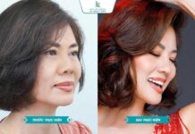 Hồ Lệ Thu và câu chuyện đồng hành cùng bác sĩ Lê Viết Trí – Giữ gìn vẻ đẹp theo cách bền vững