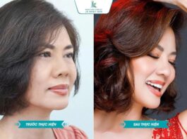 Hồ Lệ Thu và câu chuyện đồng hành cùng bác sĩ Lê Viết Trí – Giữ gìn vẻ đẹp theo cách bền vững