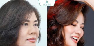 Hồ Lệ Thu và câu chuyện đồng hành cùng bác sĩ Lê Viết Trí – Giữ gìn vẻ đẹp theo cách bền vững