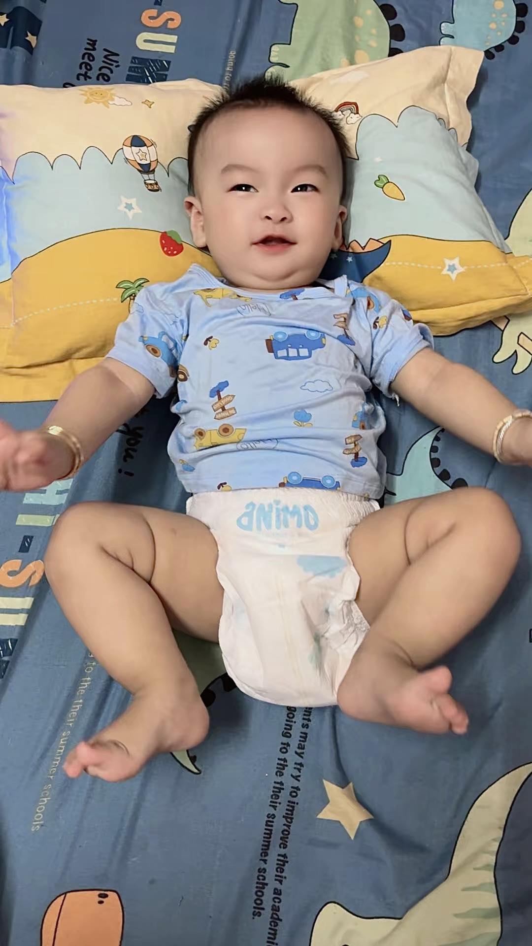 Đa số mẹ bỉm Hà Nội đang chọn bỉm sai cách, khiến con bị hăm vào mùa hè 2 2